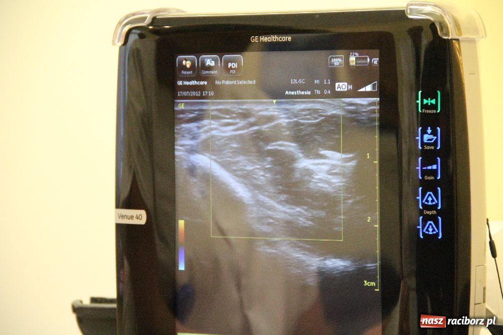 Zdjęcie w galerii na portalu naszraciborz.pl: Jedyny taki aparat w Polsce! wiadomości z regionu