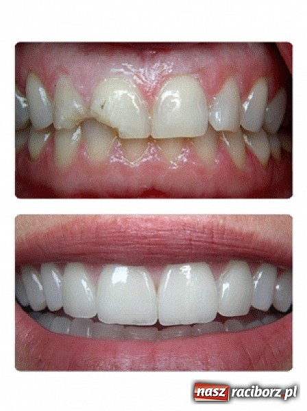 Zdjęcie w galerii na portalu naszraciborz.pl: Architekci pięknego uśmiechu wiadomości z regionu