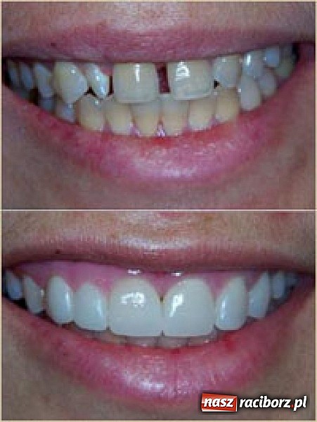 Zdjęcie w galerii na portalu naszraciborz.pl: Architekci pięknego uśmiechu wiadomości z regionu