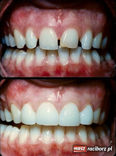 Zdjęcie w galerii na portalu naszraciborz.pl: Architekci pięknego uśmiechu wiadomości z regionu