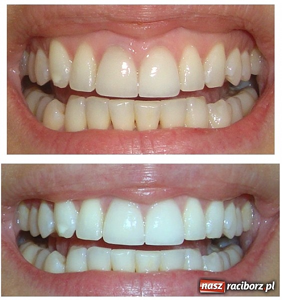 Zdjęcie w galerii na portalu naszraciborz.pl: Architekci pięknego uśmiechu wiadomości z regionu