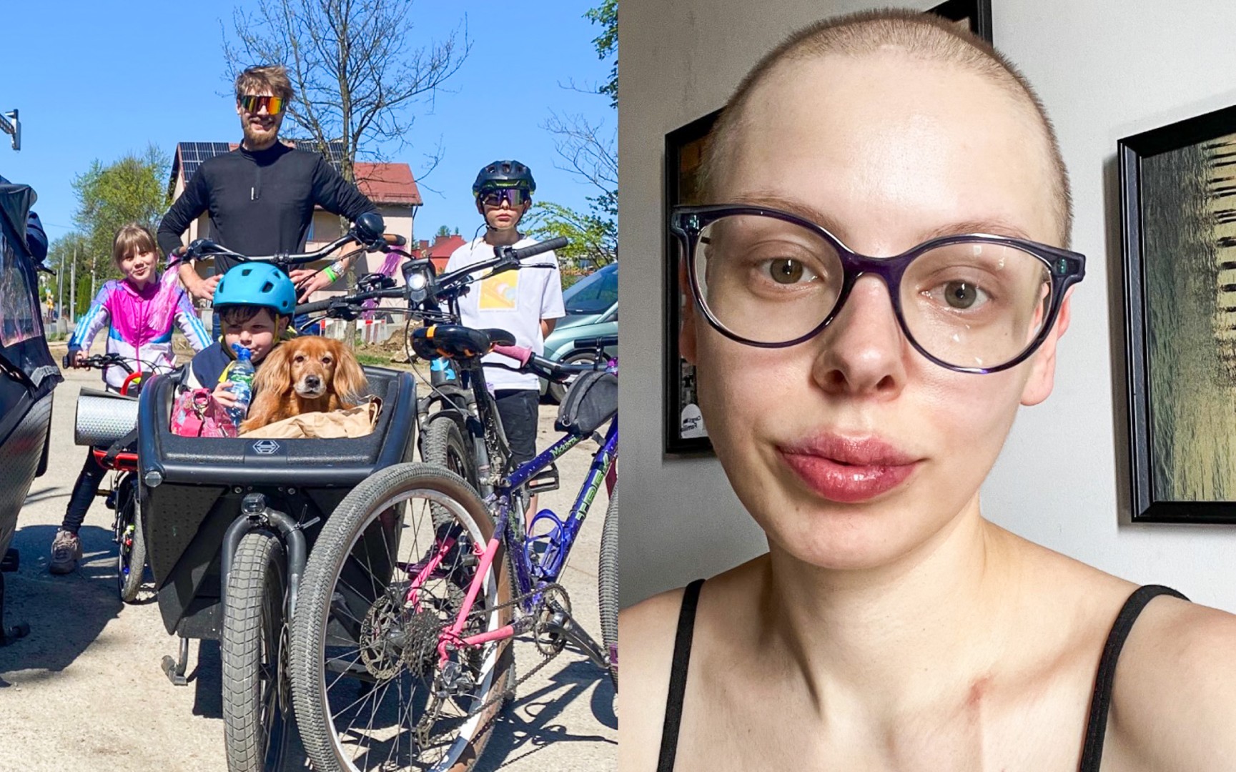 Rowerzysta ze Śląska pobity w Ostrawie. Śląskie barwy pomylono z ukraińskimi