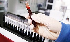 Szpital zaprasza na bezpłatne badania - Serwis informacyjny z Raciborza - naszraciborz.pl