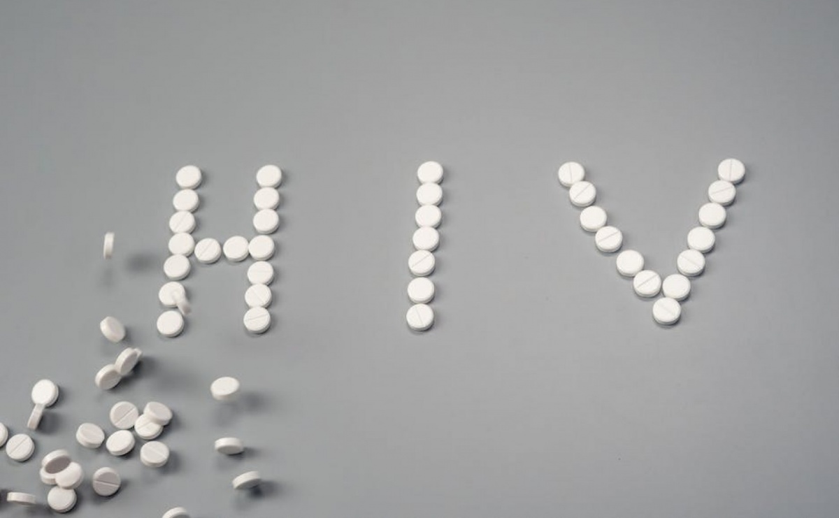 Kiedy wykonać test na HIV? - Serwis informacyjny z Raciborza - naszraciborz.pl