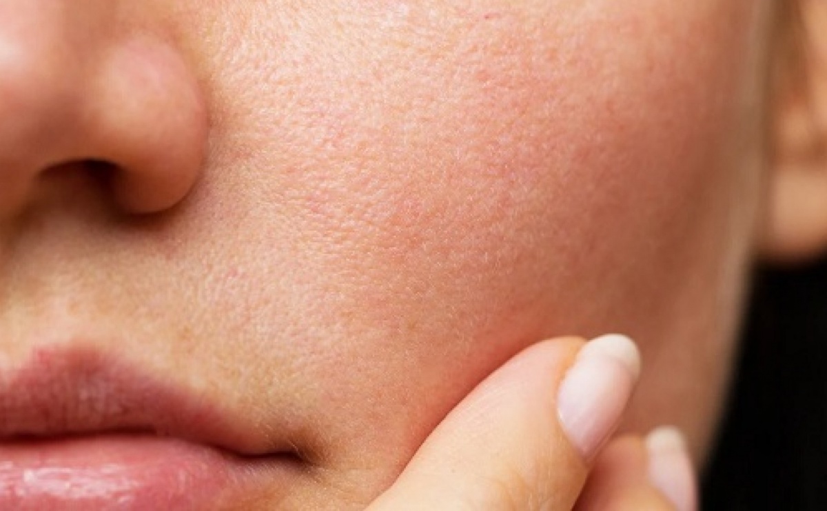 Sposoby dermatologów na utrzymanie zdrowej skóry podczas podróży - Serwis informacyjny z Raciborza - naszraciborz.pl