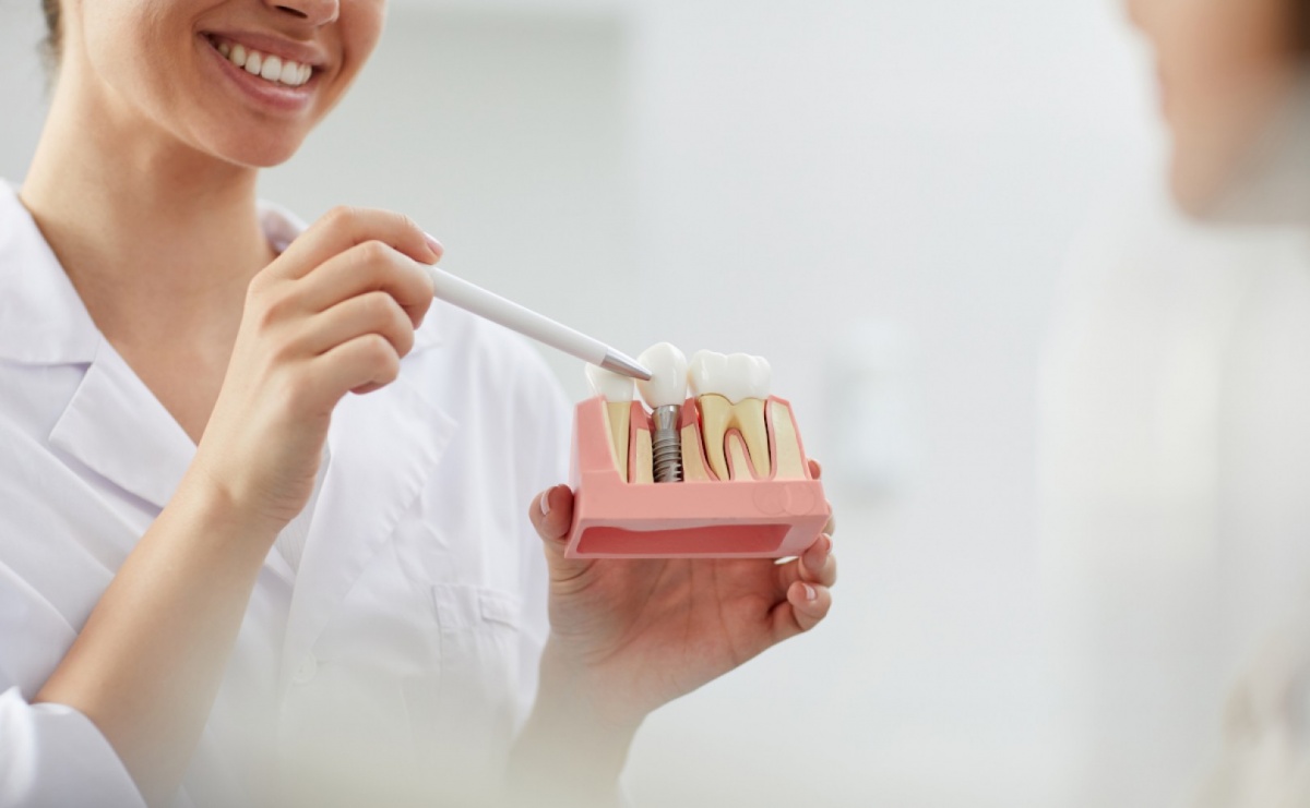 Implanty stomatologiczne - odpowiedź na piękne zęby - Serwis informacyjny z Raciborza - naszraciborz.pl