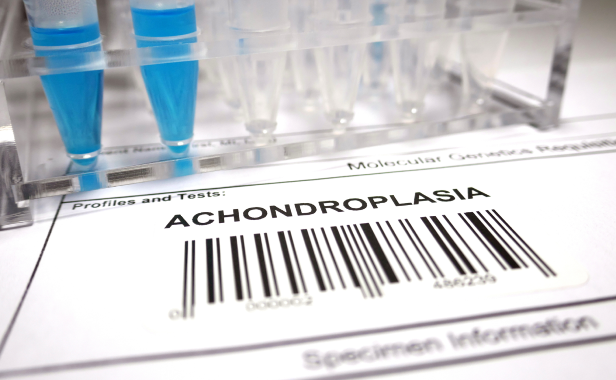 Co z lekiem na achondroplazję? Rzeczniczka Praw Dziecka pyta resort zdrowia - Serwis informacyjny z Raciborza - naszraciborz.pl