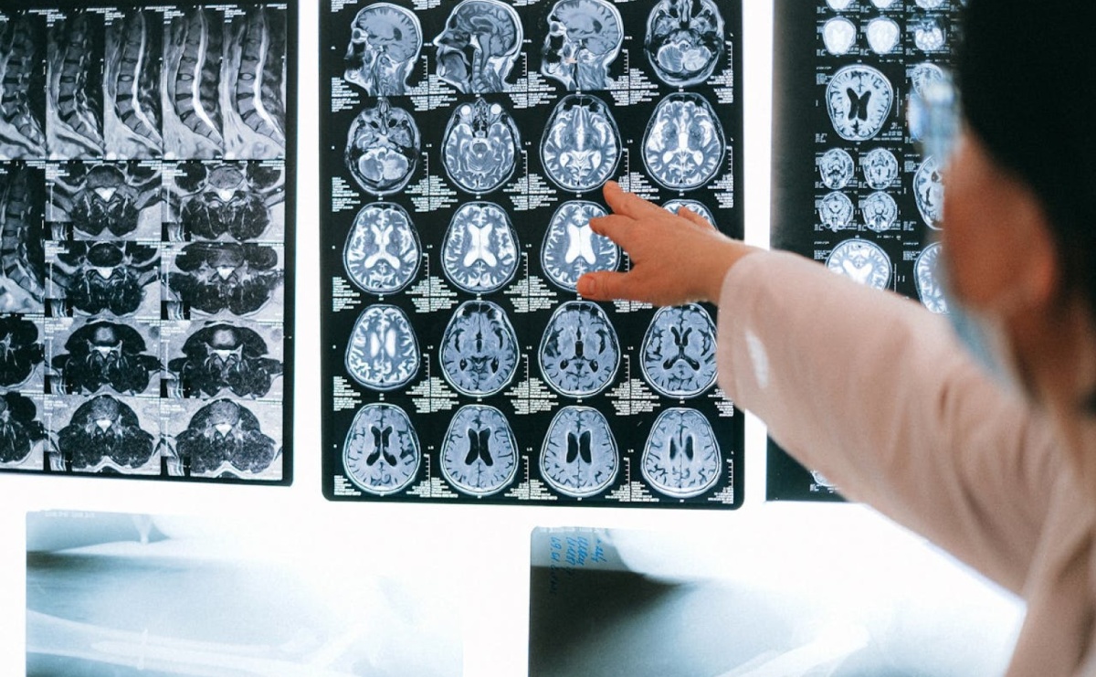 Diagnostyka przewlekłych bólów głowy – jakie badania warto zrobić? - Serwis informacyjny z Raciborza - naszraciborz.pl