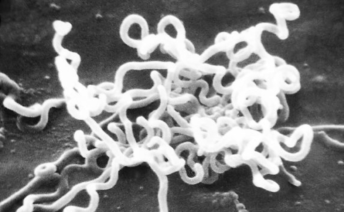 Wstydliwa choroba coraz większym problemem w powiecie raciborskim - Serwis informacyjny z Raciborza - naszraciborz.pl