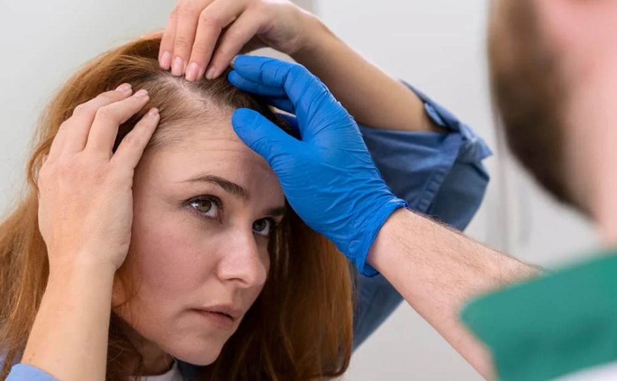Łysienie – jak rozpoznać rodzaj i co może być przyczyną? - Serwis informacyjny z Raciborza - naszraciborz.pl