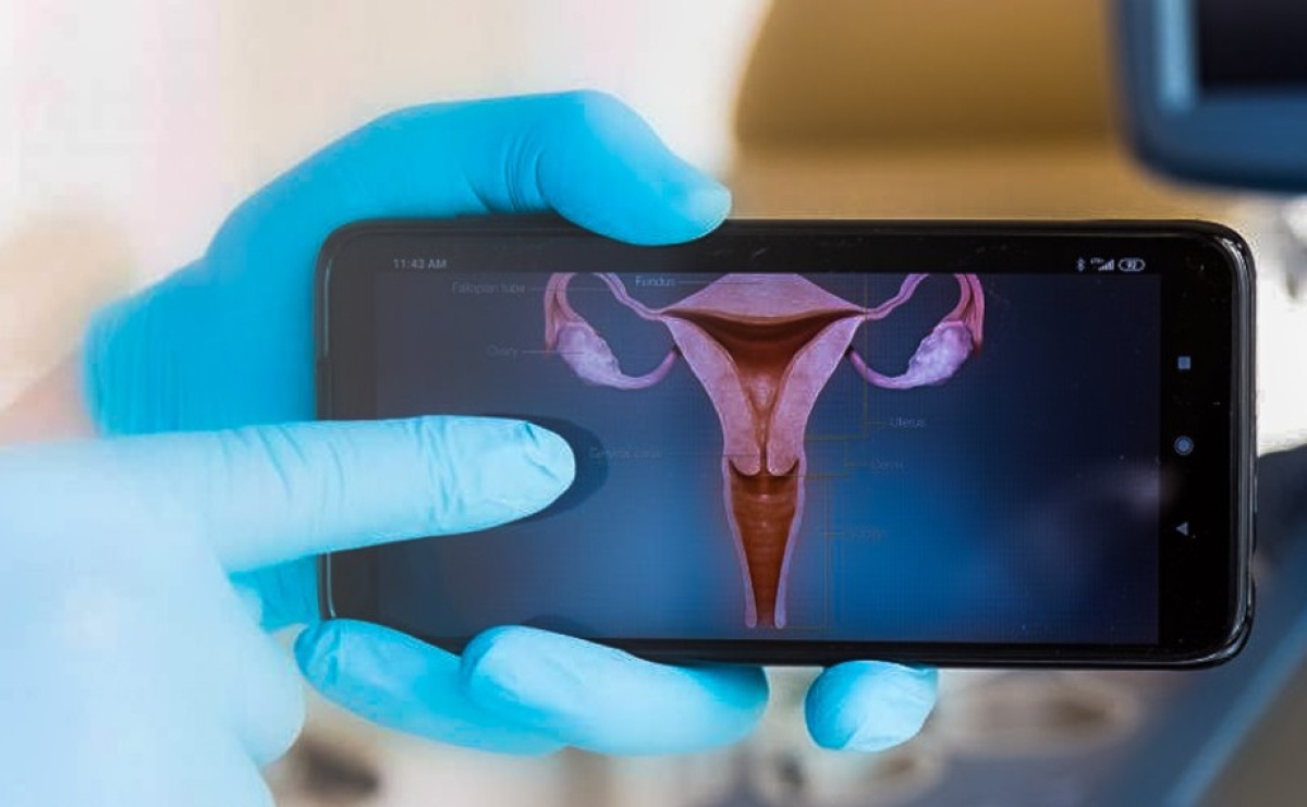 Profilaktyka raka szyjki macicy. Gdzie w województwie śląskim przebadało się najwięcej kobiet? - Serwis informacyjny z Raciborza - naszraciborz.pl