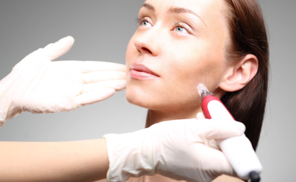Mezoterapia mikroigłowa: Jak stymulacja skóry poprawia jej jędrność i spłyca drobne zmarszczki? - Serwis informacyjny z Raciborza - naszraciborz.pl